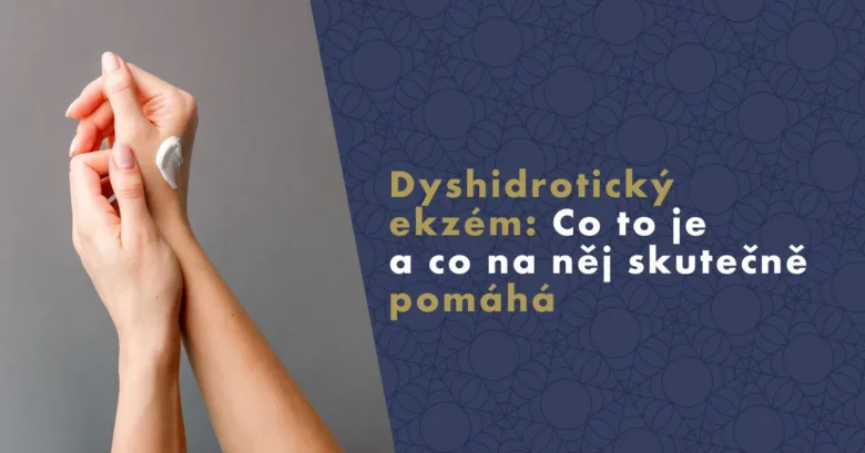 Ruce s krémem při léčbě dyshidrotického ekzému