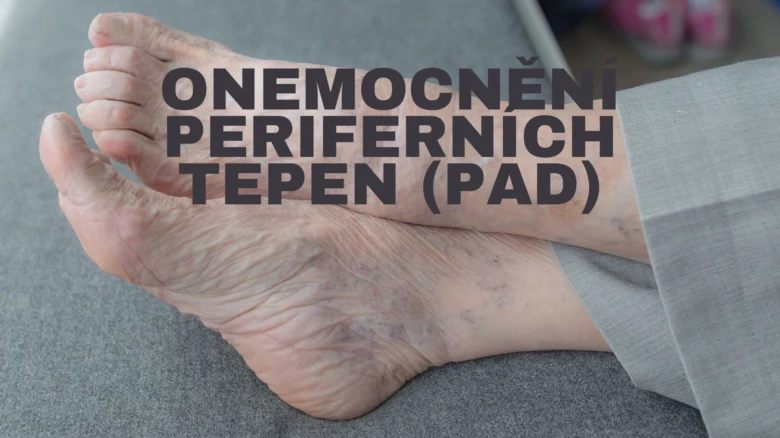 Starší nohy s příznaky onemocnění periferních tepen