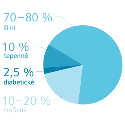 Graf typů vředů na noze s procenty pro žilní, tepenné a smíšené.