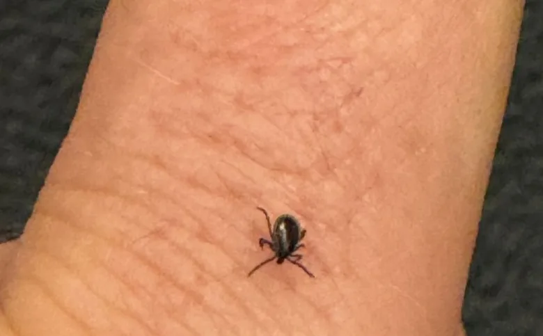 Malé klíště na lidské kůži u zápěstí