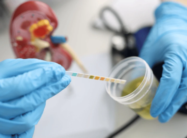Testování moči na kyselinu močovou v laboratoři