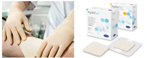 Lékař aplikuje hydrokoloidní obvaz na bércový vřed.