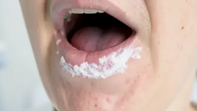 Jak rozpoznat a léčit leukoplakii - ilustrační foto