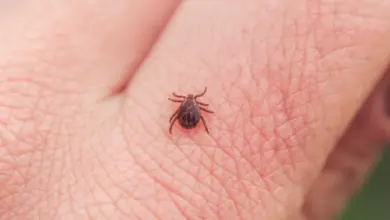 Malý klíště na lidské kůži v detailu.