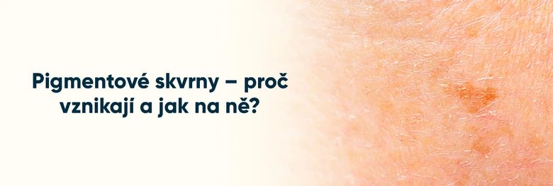 Pigmentové skvrny na kůži - příčiny a možnosti léčby.