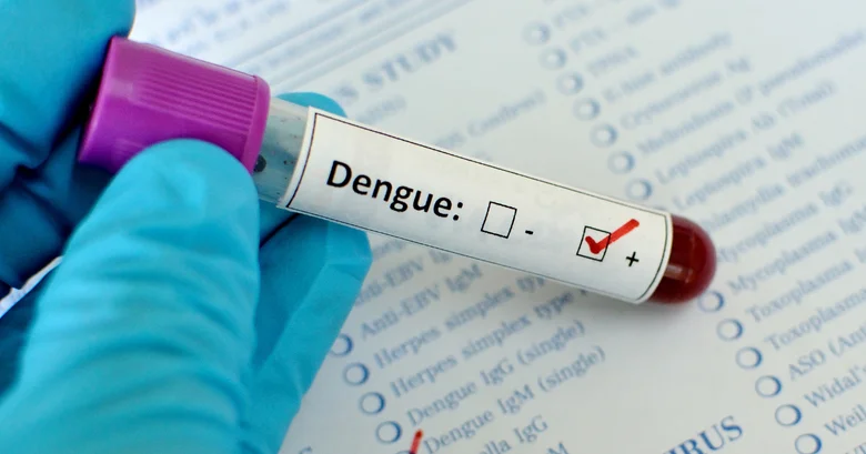 Krevní vzorek s pozitivním výsledkem testu na dengue.
