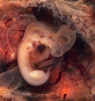 Lidské embryo v děloze během vývoje.