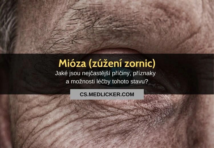 Zblížený pohled na oko s zúženou zornicí u seniora.