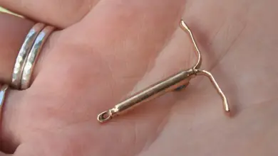 Intrauterine device (iud)