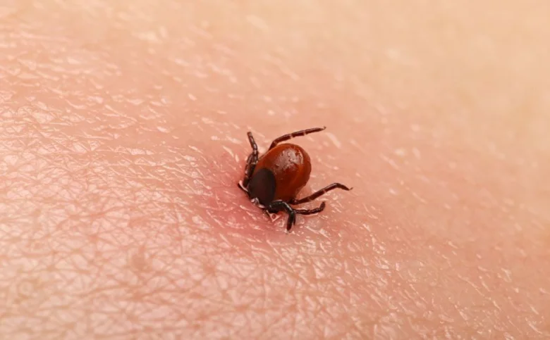 Hnědý klíště přichycené k lidské pokožce.