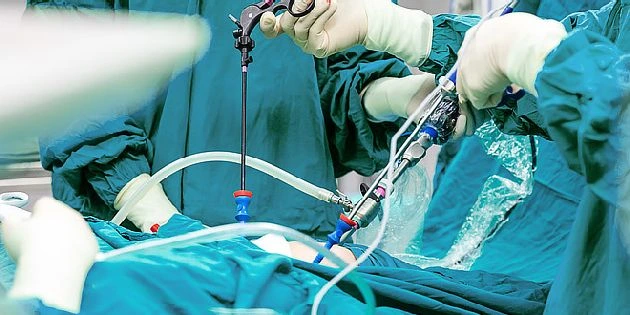 Laparoskopická operace s nástroji a rukama v chirurgických rukavicích.