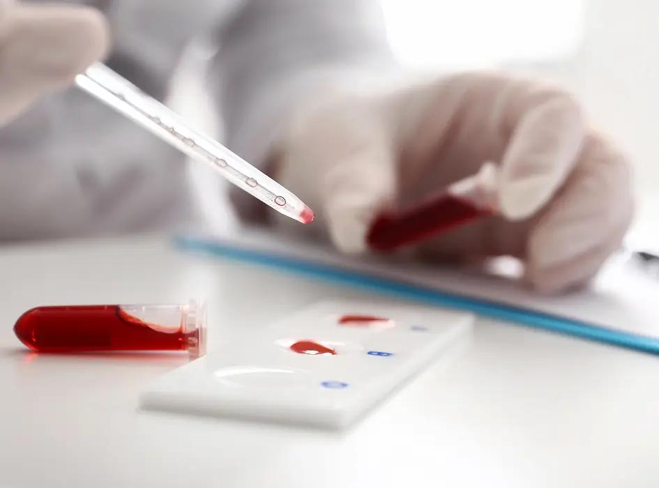 Laborant přenáší krev na diagnostický proužek pro vyšetření.